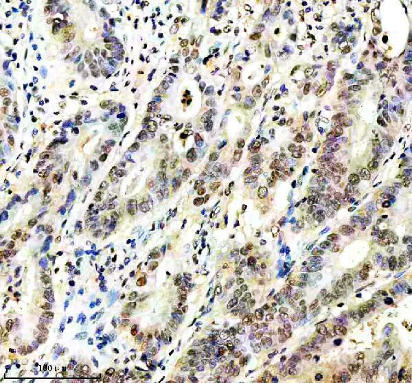 m03475 csnk2b primary antibodies ihc testing 5