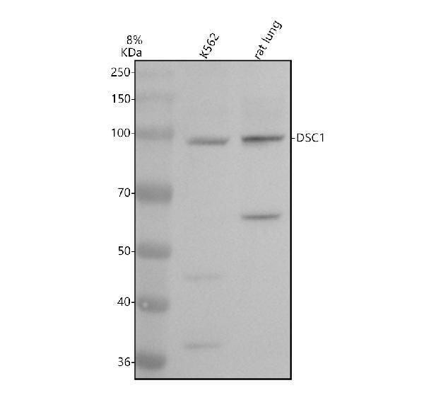 Western blot analysis of DSC1 using anti-DSC1 antibody (M03478)