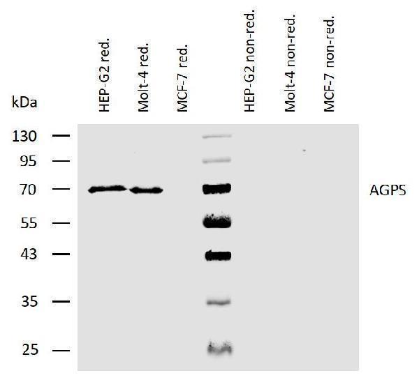 Western blotting analysis of human AGPS using mouse monoclonal antibody AGPS-03 on lysates of HEP-G2 and Molt-4 cells, and MCF-7 cells (negative control) under reducing and non-reducing conditions