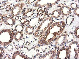 m03487 1 anti cyb5r3 mouse monoclonal antibody clone id oti2a10 ihc testing 10