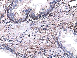 m03487 1 anti cyb5r3 mouse monoclonal antibody clone id oti2a10 ihc testing 5
