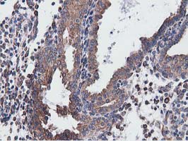 m03487 1 anti cyb5r3 mouse monoclonal antibody clone id oti2a10 ihc testing 6