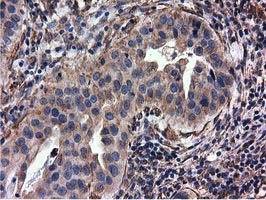 m03487 1 anti cyb5r3 mouse monoclonal antibody clone id oti2a10 ihc testing 7