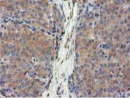 m03487 1 anti cyb5r3 mouse monoclonal antibody clone id oti2a10 ihc testing 8