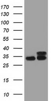 HEK293T cells were transfected with the pCMV6-ENTRY control (Left lane) or pCMV6-ENTRY CYB5R3 (Right lane) cDNA for 48 hrs and lysed