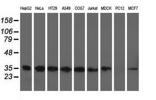 Western blot analysis of extracts (35ug) from 9 different cell lines by using anti-CYB5R3 monoclonal antibody