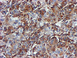 m03487 anti cyb5r3 mouse monoclonal antibody clone id oti1e8 ihc testing 11