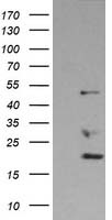 HEK293T cells were transfected with the pCMV6-ENTRY control (Left lane) or pCMV6-ENTRY BAT1 (Right lane) cDNA for 48 hrs and lysed