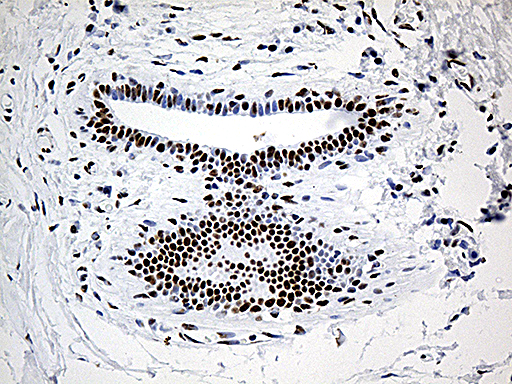 m03490 2 anti uap56 ddx39b mouse monoclonal antibody clone id oti2g7 ihc testing 3