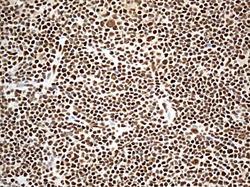 m03490 2 anti uap56 ddx39b mouse monoclonal antibody clone id oti2g7 ihc testing 4