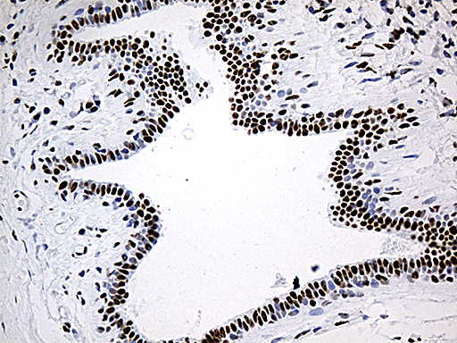 Immunohistochemical staining of paraffin-embedded Human breast tissue within the normal limits using anti-DDX39B mouse monoclonal antibody