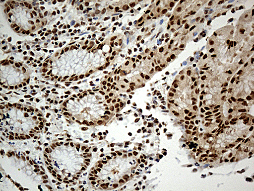 m03490 anti uap56 ddx39b mouse monoclonal antibody clone id oti2f11 ihc testing 4
