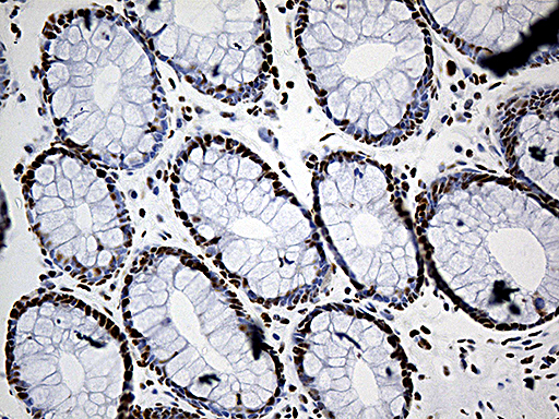 m03490 anti uap56 ddx39b mouse monoclonal antibody clone id oti2f11 ihc testing 6