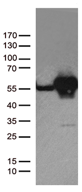 HEK293T cells were transfected with the pCMV6-ENTRY control (Left lane) or pCMV6-ENTRY DDX39B (Right lane) cDNA for 48 hrs and lysed