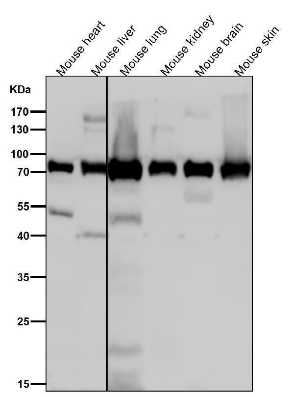 All lanes use the Antibody at 1:1W dilution for 1 hour at room temperature