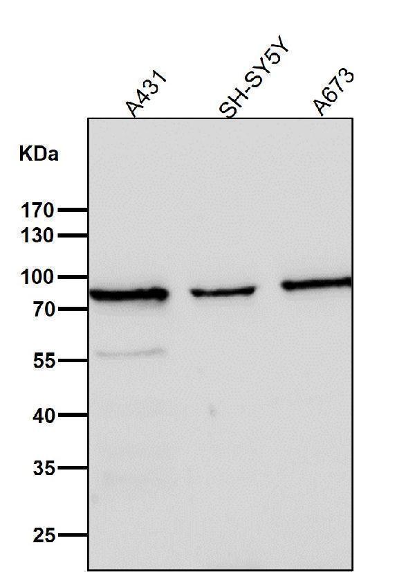 All lanes use the Antibody at 1:1W dilution for 1 hour at room temperature