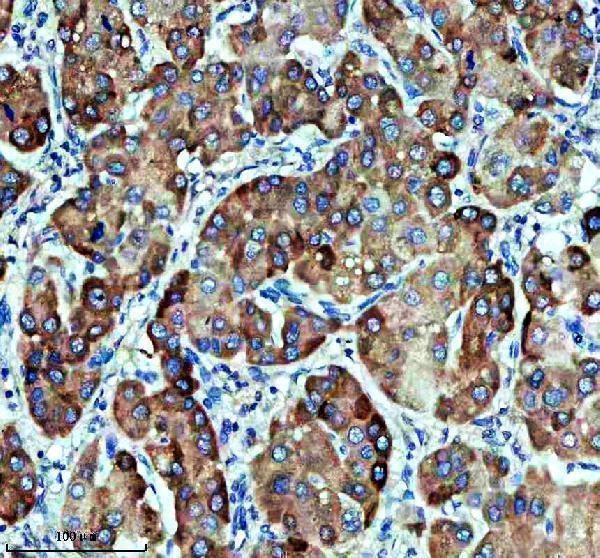 IHC analysis of CYP4A11 using anti-CYP4A11 antibody (M03493)