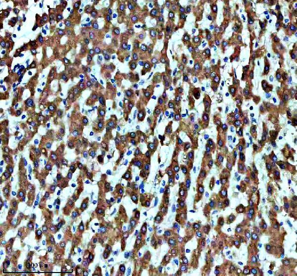 IHC analysis of CYP4A11 using anti-CYP4A11 antibody (M03493)