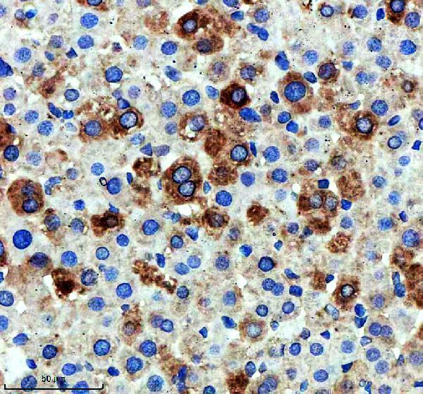 m03493 cyp4a11 primary antibodies ihc testing 3