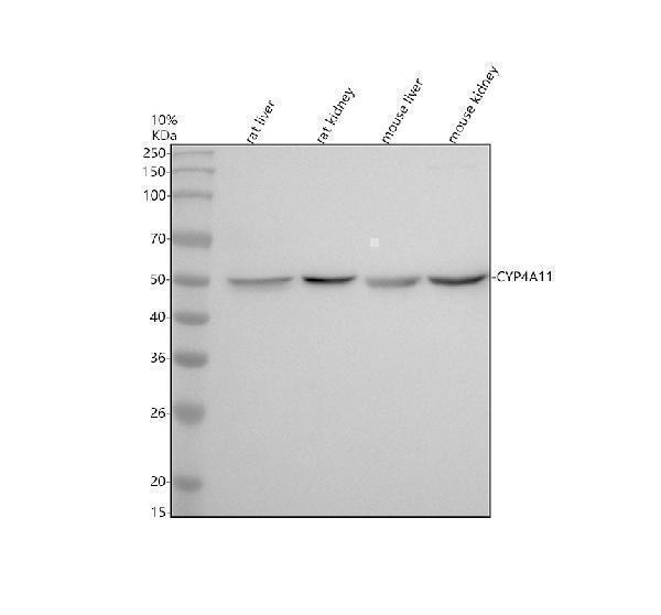 Western blot analysis of CYP4A11 using anti-CYP4A11 antibody (M03493)