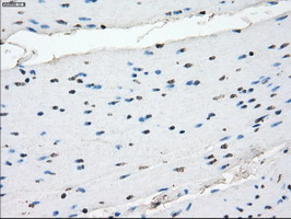 Immunohistochemical staining of paraffin-embedded Human colon tissue within the normal limits using anti-CRYAB mouse monoclonal antibody