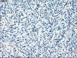 m03496 1 anti alpha b crystallin cryab mouse monoclonal antibody clone id oti6g5 ihc testing 2