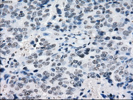 m03496 1 anti alpha b crystallin cryab mouse monoclonal antibody clone id oti6g5 ihc testing 3