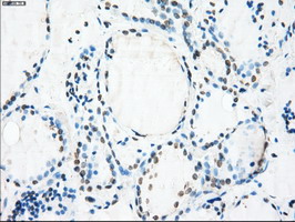 m03496 1 anti alpha b crystallin cryab mouse monoclonal antibody clone id oti6g5 ihc testing 4