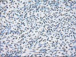 m03496 1 anti alpha b crystallin cryab mouse monoclonal antibody clone id oti6g5 ihc testing 5