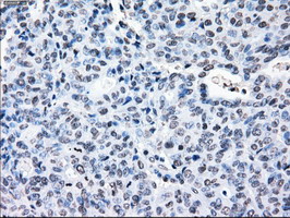 m03496 1 anti alpha b crystallin cryab mouse monoclonal antibody clone id oti6g5 ihc testing 6