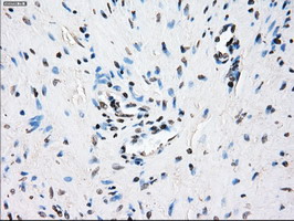 m03496 1 anti alpha b crystallin cryab mouse monoclonal antibody clone id oti6g5 ihc testing 7