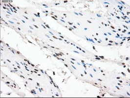 m03496 1 anti alpha b crystallin cryab mouse monoclonal antibody clone id oti6g5 ihc testing 8
