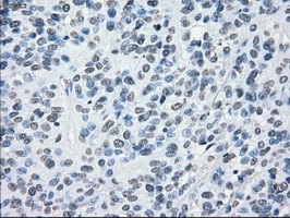 m03496 1 anti alpha b crystallin cryab mouse monoclonal antibody clone id oti6g5 ihc testing 9