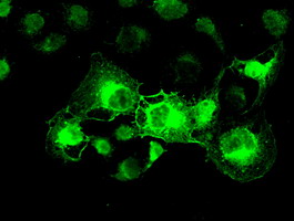 m03496 2 anti alpha b crystallin cryab mouse monoclonal antibody clone id oti6d11 if testing 7