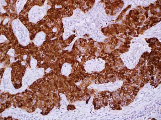 m03496 2 anti alpha b crystallin cryab mouse monoclonal antibody clone id oti6d11 ihc testing 4