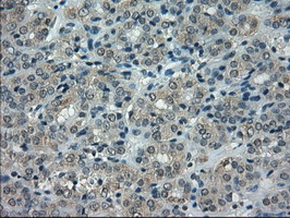 m03496 2 anti alpha b crystallin cryab mouse monoclonal antibody clone id oti6d11 ihc testing 5