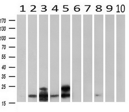m03496 2 anti alpha b crystallin cryab mouse monoclonal antibody clone id oti6d11 wb testing 2