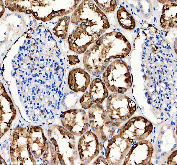 IHC analysis of Alpha B Crystallin/CRYAB using anti-Alpha B Crystallin/CRYAB antibody (M03496)