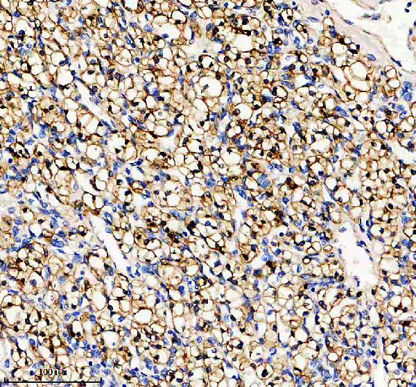 IHC analysis of Alpha B Crystallin/CRYAB using anti-Alpha B Crystallin/CRYAB antibody (M03496)