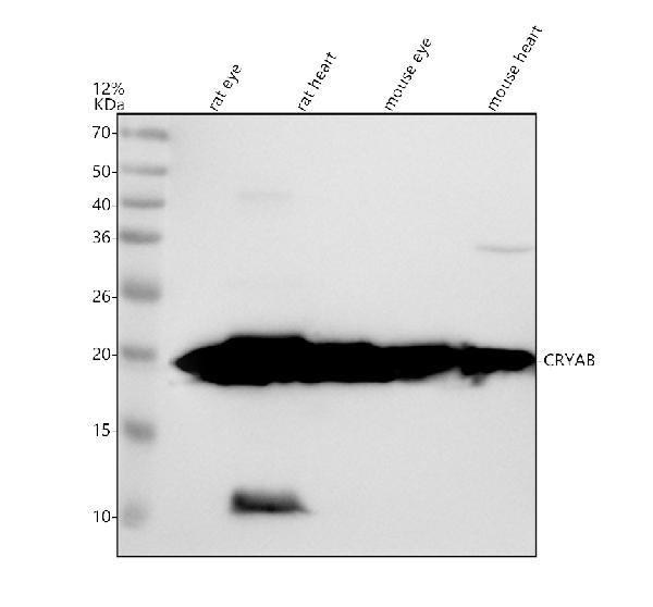 Western blot analysis of Alpha B Crystallin/CRYAB using anti-Alpha B Crystallin/CRYAB antibody (M03496)