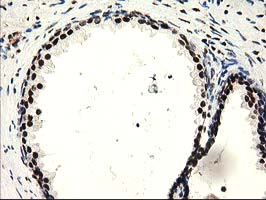 m03500 1 anti sult1a1 mouse monoclonal antibody clone id oti9b7 ihc testing 3