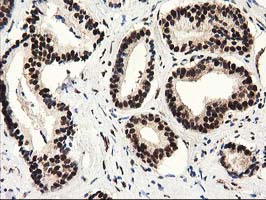 m03500 1 anti sult1a1 mouse monoclonal antibody clone id oti9b7 ihc testing 4