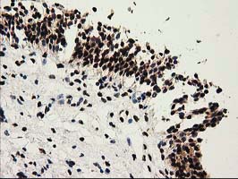 m03500 1 anti sult1a1 mouse monoclonal antibody clone id oti9b7 ihc testing 5