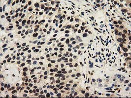 m03500 1 anti sult1a1 mouse monoclonal antibody clone id oti9b7 ihc testing 6