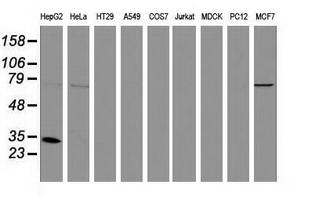 m03500 1 anti sult1a1 mouse monoclonal antibody clone id oti9b7 wb testing 2