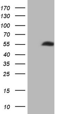 m03504 anti nob1 mouse monoclonal antibody clone id oti1c12 wb testing 1