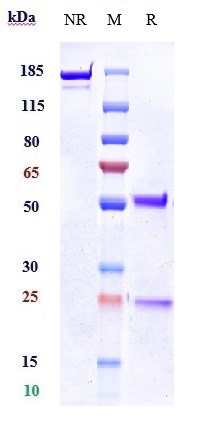 Anti-KLK5/Kallikrein 5 Reference Antibody (Genentech patent anti-KLK5) on SDS-PAGE under reducing (R) condition