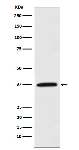 Western blot analysis of Kallikrein 5 expression in MCF-7 cell lysate.