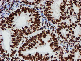 m03515 1 anti nono mouse monoclonal antibody clone id oti4d9 ihc testing 11