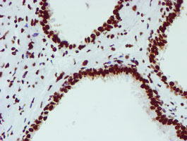 m03515 1 anti nono mouse monoclonal antibody clone id oti4d9 ihc testing 12